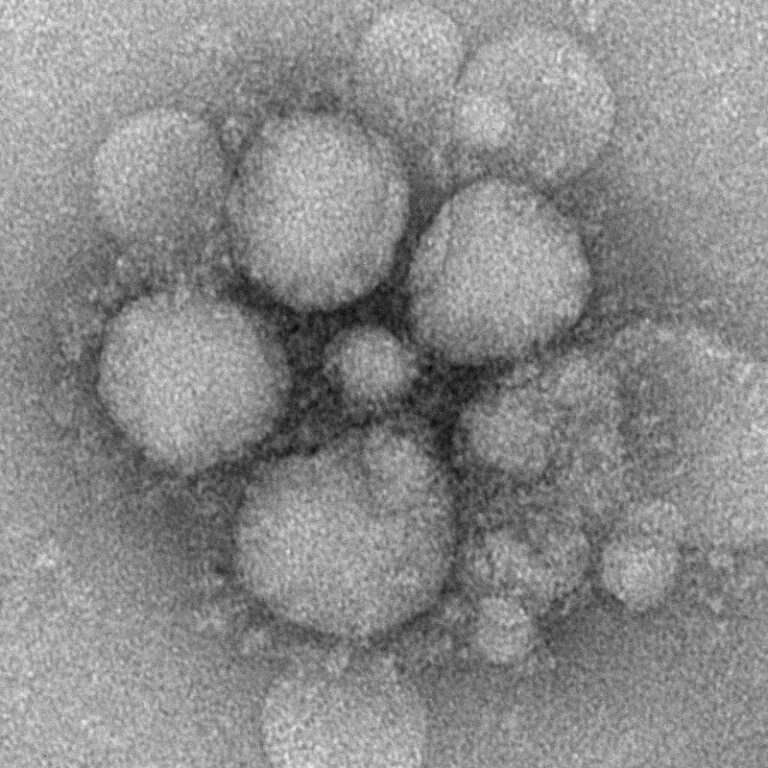 800px-MERS-CoV_electron_micrograph3